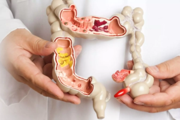 Colon & Rectal Surgery